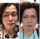 Anu Beauty Center
